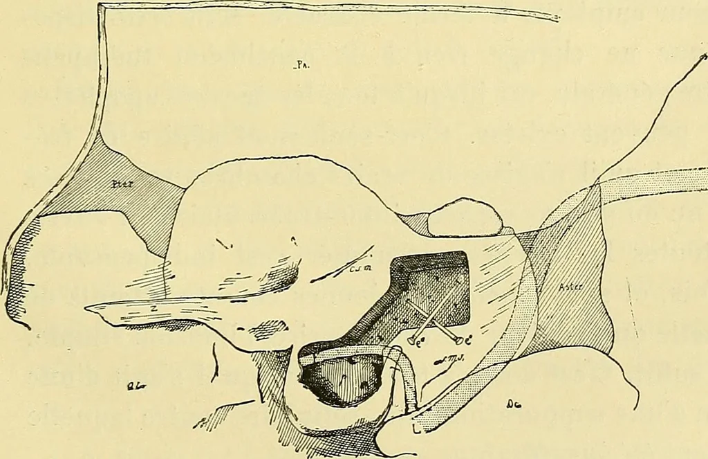 An illustration from Leçons cliniques de chirurgie infantile : deuxième série, 1905, leaf 566