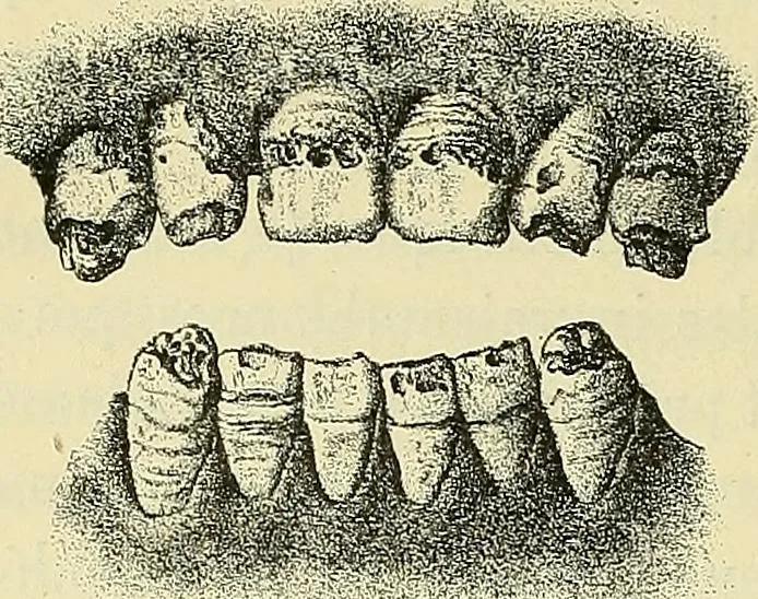 An illustration from Leçons cliniques de chirurgie infantile : deuxième série, 1905, leaf 59