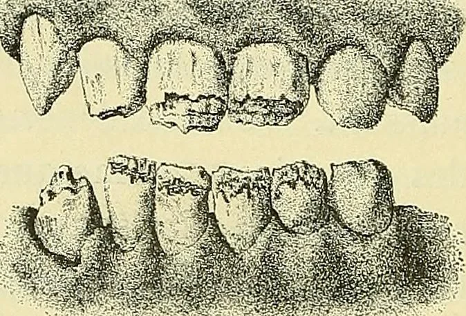 An illustration from Leçons cliniques de chirurgie infantile : deuxième série, 1905, leaf 59