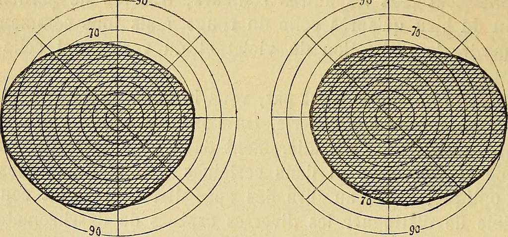 An illustration from Leçons cliniques sur l'hystérie et l'hypnotisme : faites à l'Hôpital Saint-André de Bordeaux, 1891, leaf 115