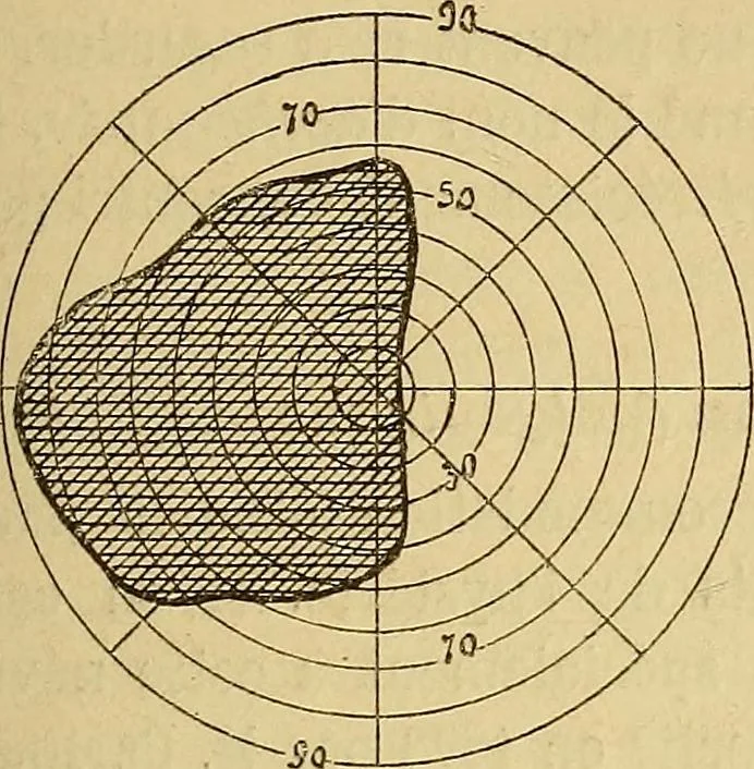 An illustration from Leçons cliniques sur l'hystérie et l'hypnotisme : faites à l'Hôpital Saint-André de Bordeaux, 1891, leaf 116