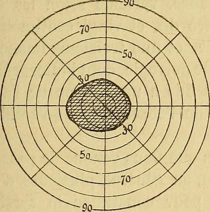 An illustration from Leçons cliniques sur l'hystérie et l'hypnotisme : faites à l'Hôpital Saint-André de Bordeaux, 1891, leaf 116