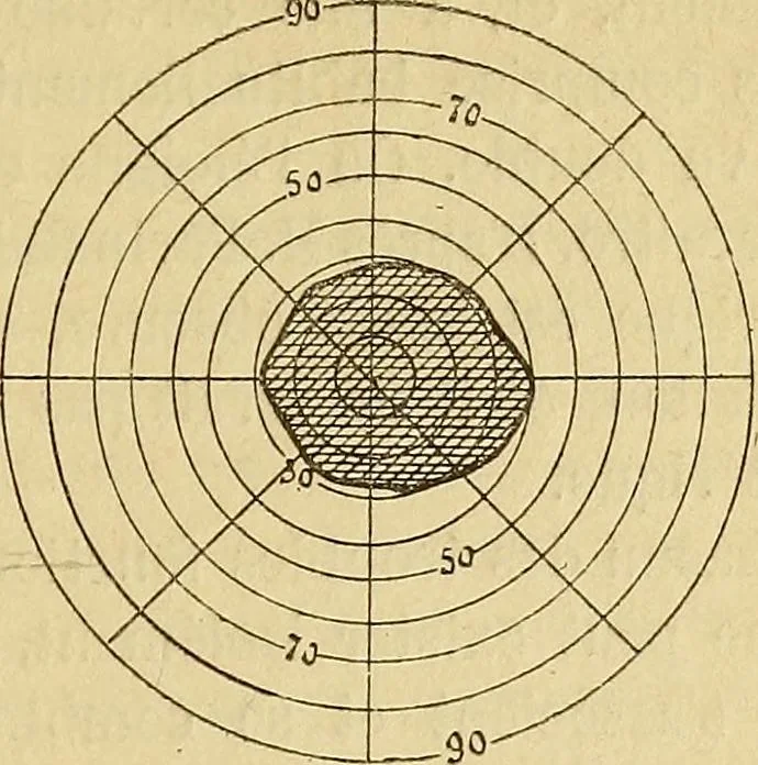 An illustration from Leçons cliniques sur l'hystérie et l'hypnotisme : faites à l'Hôpital Saint-André de Bordeaux, 1891, leaf 116