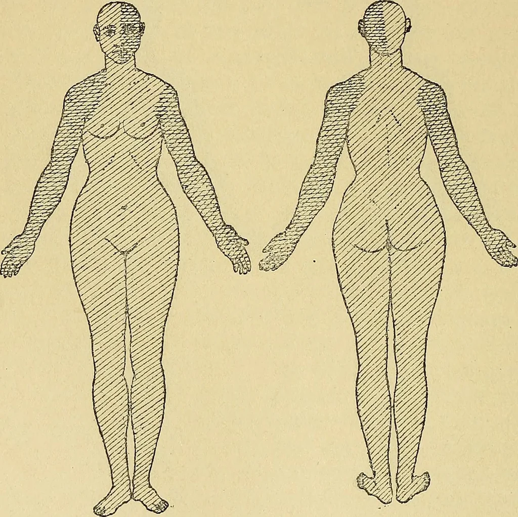 An illustration from Leçons cliniques sur l'hystérie et l'hypnotisme : faites à l'Hôpital Saint-André de Bordeaux, 1891, leaf 147