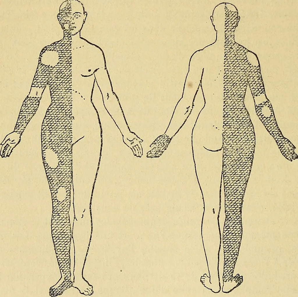 An illustration from Leçons cliniques sur l'hystérie et l'hypnotisme : faites à l'Hôpital Saint-André de Bordeaux, 1891, leaf 203