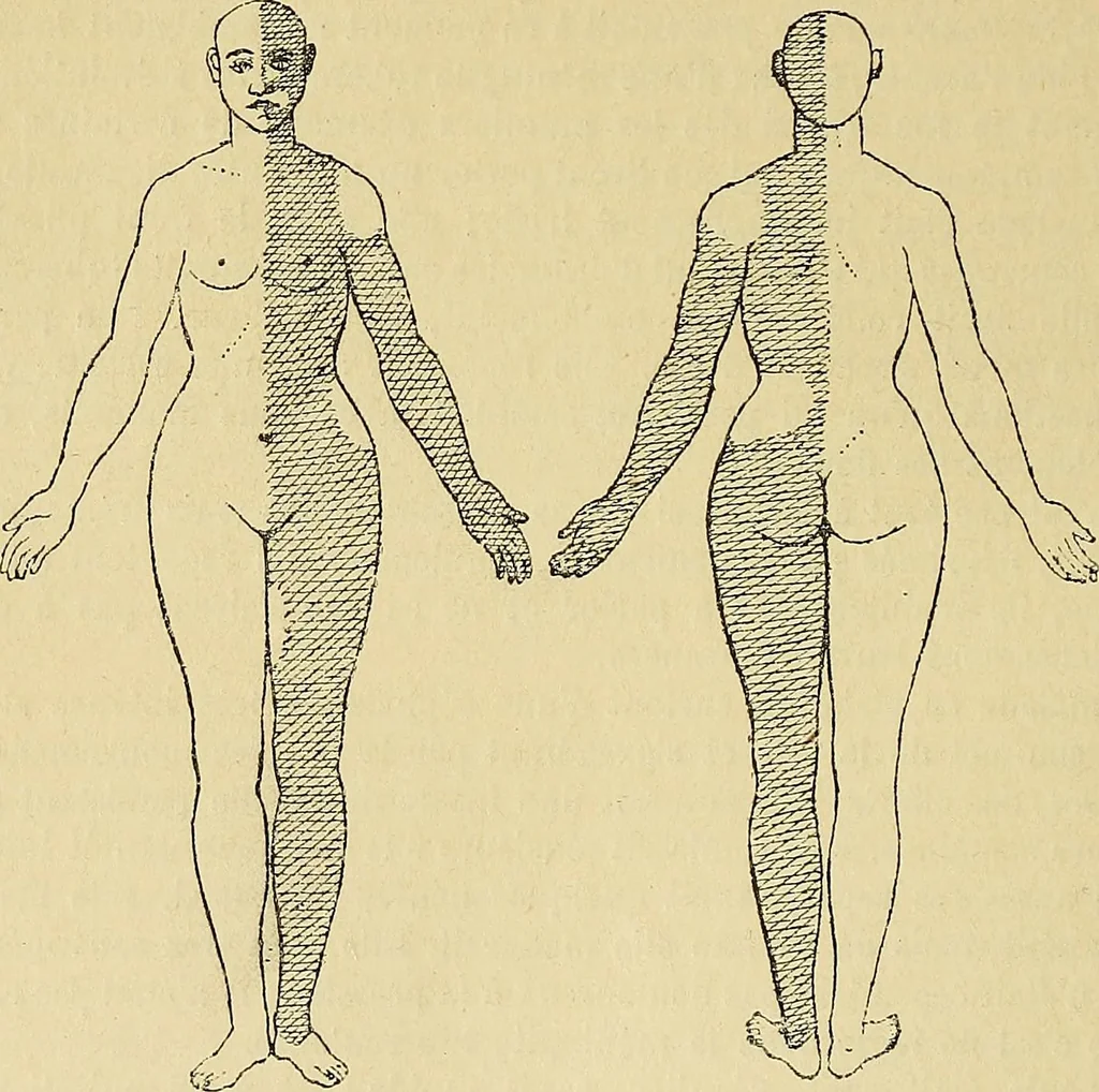 An illustration from Leçons cliniques sur l'hystérie et l'hypnotisme : faites à l'Hôpital Saint-André de Bordeaux, 1891, leaf 221