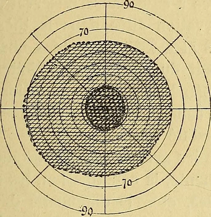 An illustration from Leçons cliniques sur l'hystérie et l'hypnotisme : faites à l'Hôpital Saint-André de Bordeaux, 1891, leaf 222
