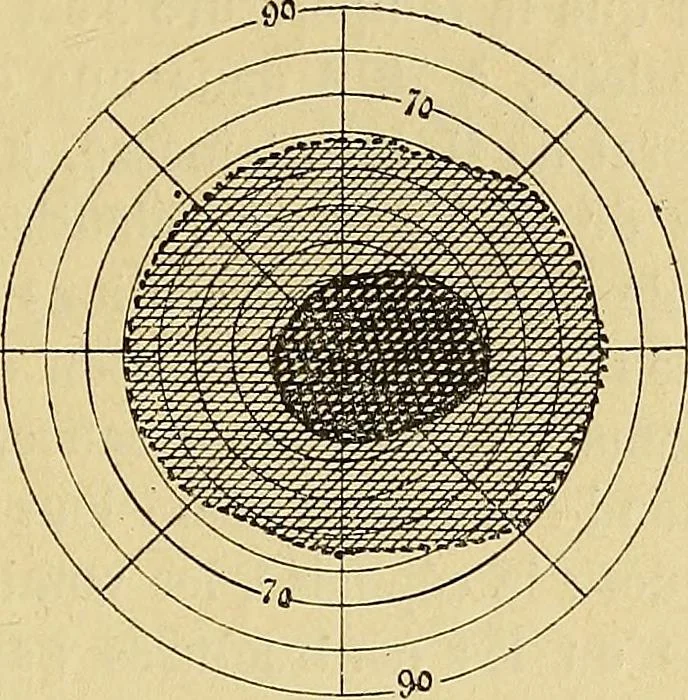An illustration from Leçons cliniques sur l'hystérie et l'hypnotisme : faites à l'Hôpital Saint-André de Bordeaux, 1891, leaf 222