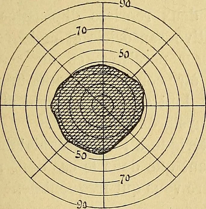 An illustration from Leçons cliniques sur l'hystérie et l'hypnotisme : faites à l'Hôpital Saint-André de Bordeaux, 1891, leaf 308