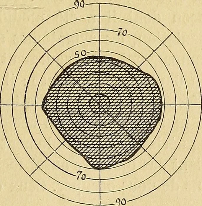 An illustration from Leçons cliniques sur l'hystérie et l'hypnotisme : faites à l'Hôpital Saint-André de Bordeaux, 1891, leaf 308
