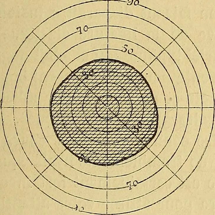 An illustration from Leçons cliniques sur l'hystérie et l'hypnotisme : faites à l'Hôpital Saint-André de Bordeaux, 1891, leaf 322