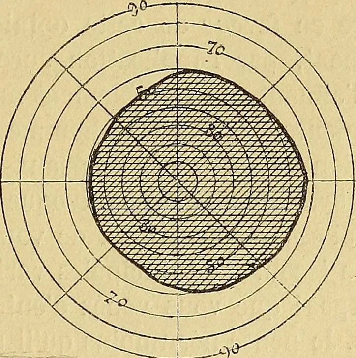 An illustration from Leçons cliniques sur l'hystérie et l'hypnotisme : faites à l'Hôpital Saint-André de Bordeaux, 1891, leaf 322