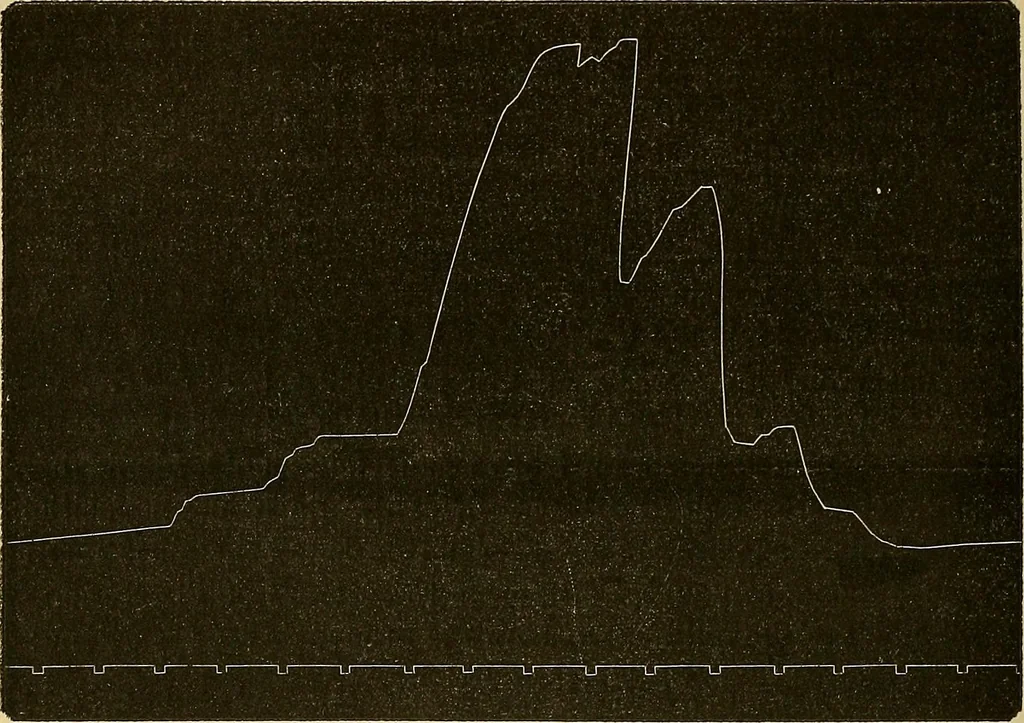 An illustration from Leçons cliniques sur l'hystérie et l'hypnotisme : faites à l'Hôpital Saint-André de Bordeaux, 1891, leaf 335