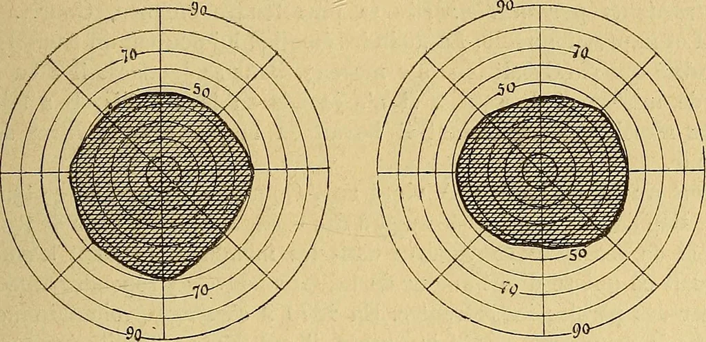 An illustration from Leçons cliniques sur l'hystérie et l'hypnotisme : faites à l'Hôpital Saint-André de Bordeaux, 1891, leaf 336