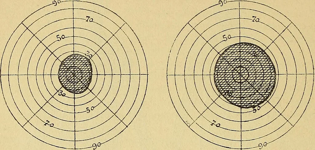 An illustration from Leçons cliniques sur l'hystérie et l'hypnotisme : faites à l'Hôpital Saint-André de Bordeaux, 1891, leaf 339