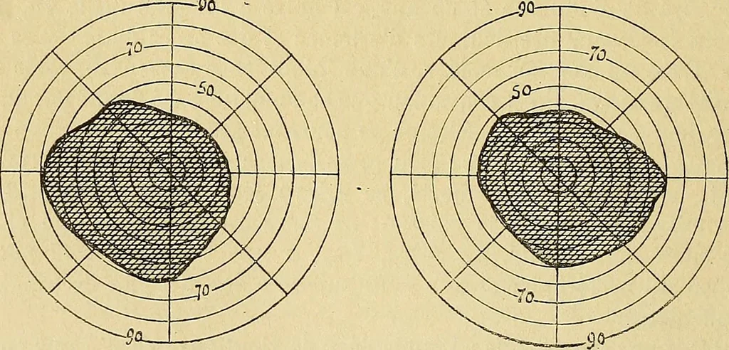 An illustration from Leçons cliniques sur l'hystérie et l'hypnotisme : faites à l'Hôpital Saint-André de Bordeaux, 1891, leaf 347