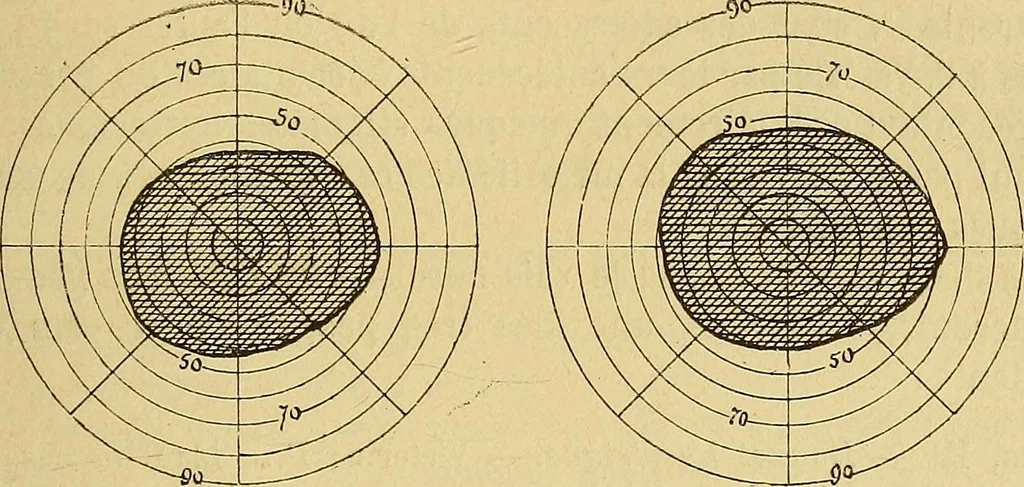 An illustration from Leçons cliniques sur l'hystérie et l'hypnotisme : faites à l'Hôpital Saint-André de Bordeaux, 1891, leaf 356