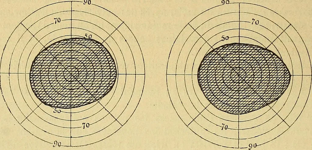 An illustration from Leçons cliniques sur l'hystérie et l'hypnotisme : faites à l'Hôpital Saint-André de Bordeaux, 1891, leaf 359