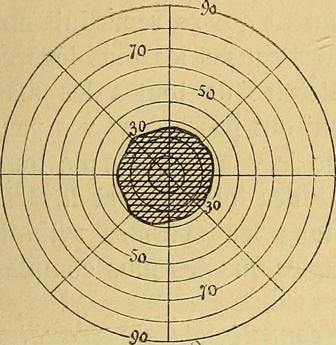 An illustration from Leçons cliniques sur l'hystérie et l'hypnotisme : faites à l'Hôpital Saint-André de Bordeaux, 1891, leaf 368