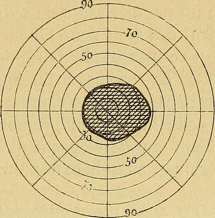 An illustration from Leçons cliniques sur l'hystérie et l'hypnotisme : faites à l'Hôpital Saint-André de Bordeaux, 1891, leaf 368