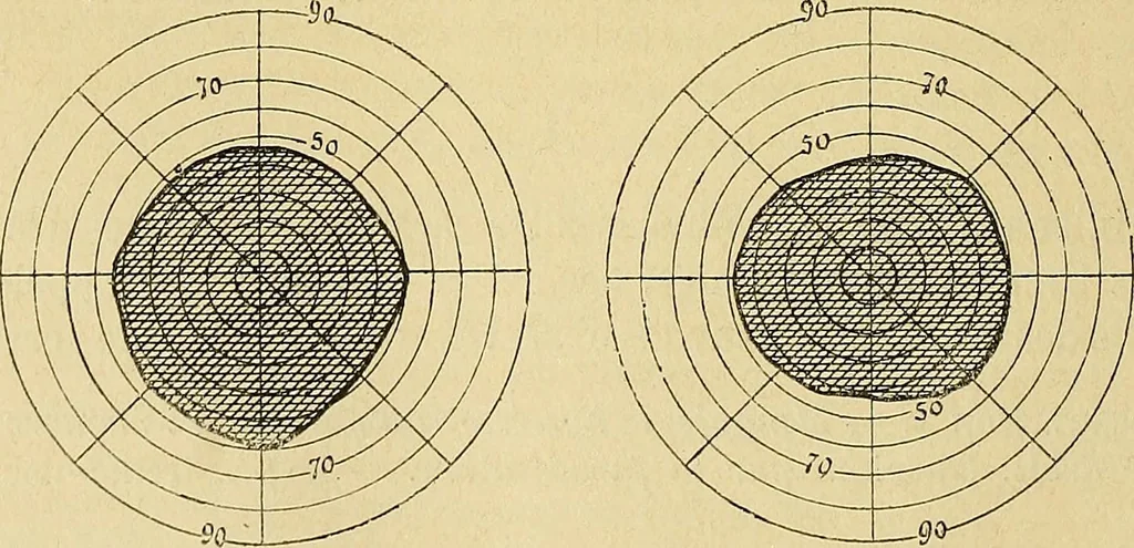An illustration from Leçons cliniques sur l'hystérie et l'hypnotisme : faites à l'Hôpital Saint-André de Bordeaux, 1891, leaf 437