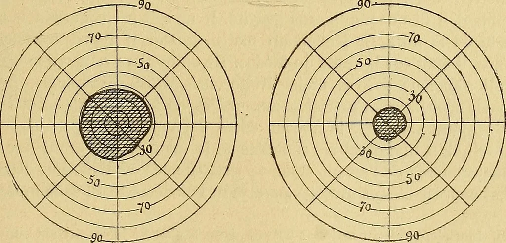 An illustration from Leçons cliniques sur l'hystérie et l'hypnotisme : faites à l'Hôpital Saint-André de Bordeaux, 1891, leaf 440