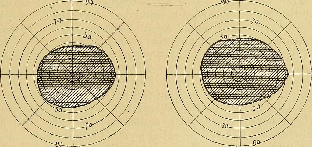 An illustration from Leçons cliniques sur l'hystérie et l'hypnotisme : faites à l'Hôpital Saint-André de Bordeaux, 1891, leaf 442