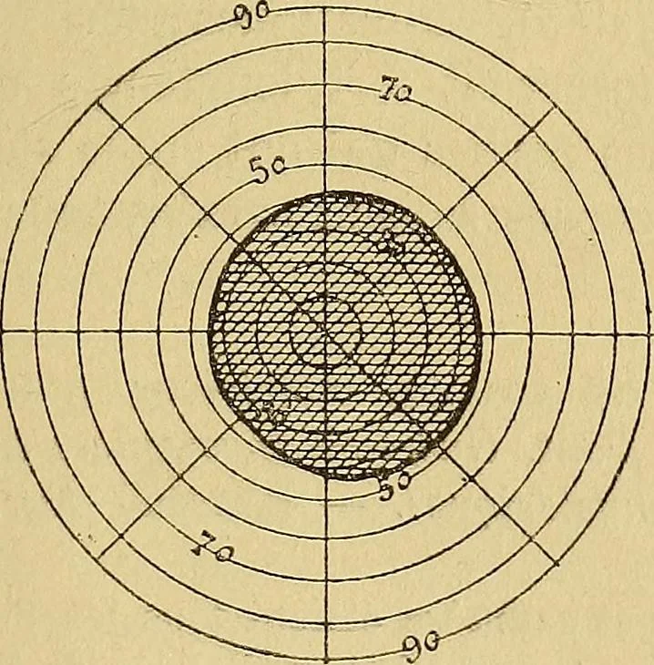 An illustration from Leçons cliniques sur l'hystérie et l'hypnotisme : faites à l'Hôpital Saint-André de Bordeaux, 1891, leaf 444