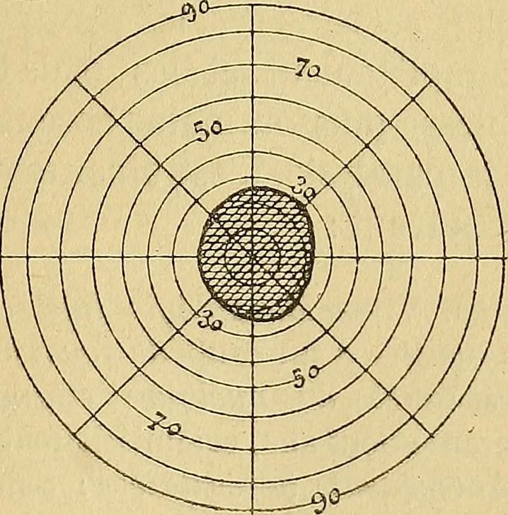 An illustration from Leçons cliniques sur l'hystérie et l'hypnotisme : faites à l'Hôpital Saint-André de Bordeaux, 1891, leaf 444
