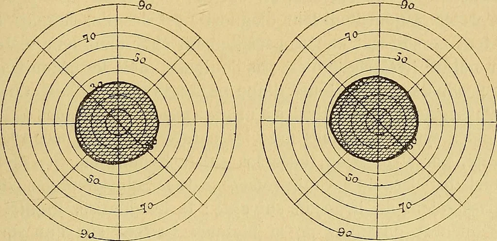 An illustration from Leçons cliniques sur l'hystérie et l'hypnotisme : faites à l'Hôpital Saint-André de Bordeaux, 1891, leaf 446