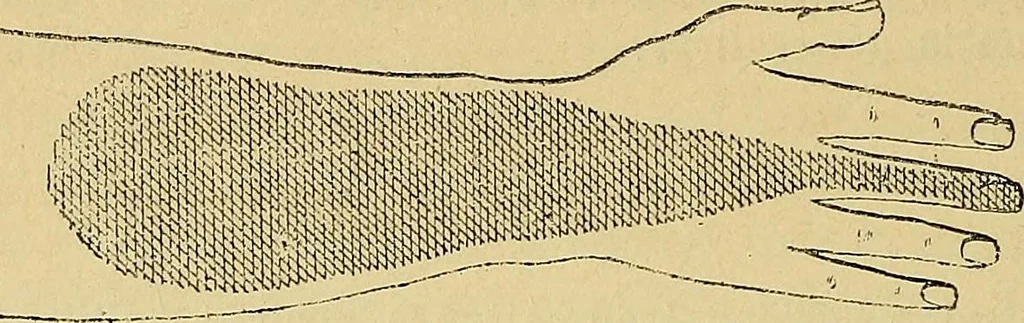An illustration from Leçons cliniques sur l'hystérie et l'hypnotisme : faites à l'Hôpital Saint-André de Bordeaux, 1891, leaf 449