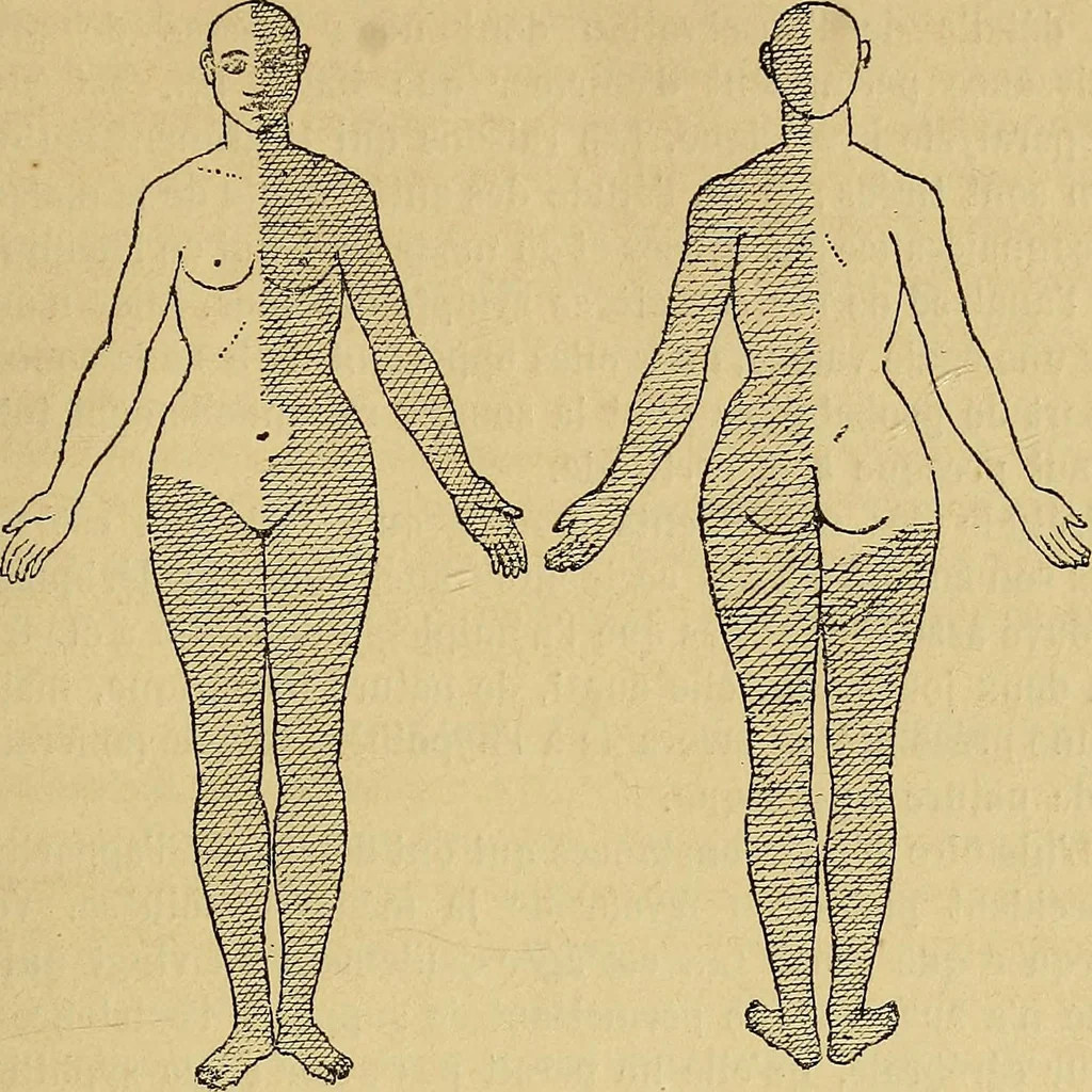 An illustration from Leçons cliniques sur l'hystérie et l'hypnotisme : faites à l'Hôpital Saint-André de Bordeaux, 1891, leaf 454
