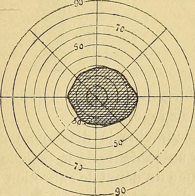 An illustration from Leçons cliniques sur l'hystérie et l'hypnotisme : faites à l'Hôpital Saint-André de Bordeaux, 1891, leaf 468