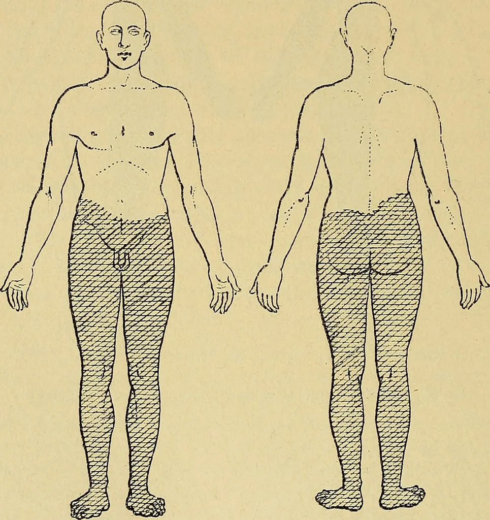 An illustration from Leçons cliniques sur l'hystérie et l'hypnotisme : faites à l'Hôpital Saint-André de Bordeaux, 1891, leaf 469