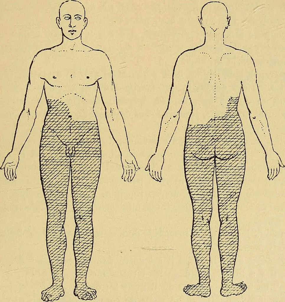 An illustration from Leçons cliniques sur l'hystérie et l'hypnotisme : faites à l'Hôpital Saint-André de Bordeaux, 1891, leaf 470