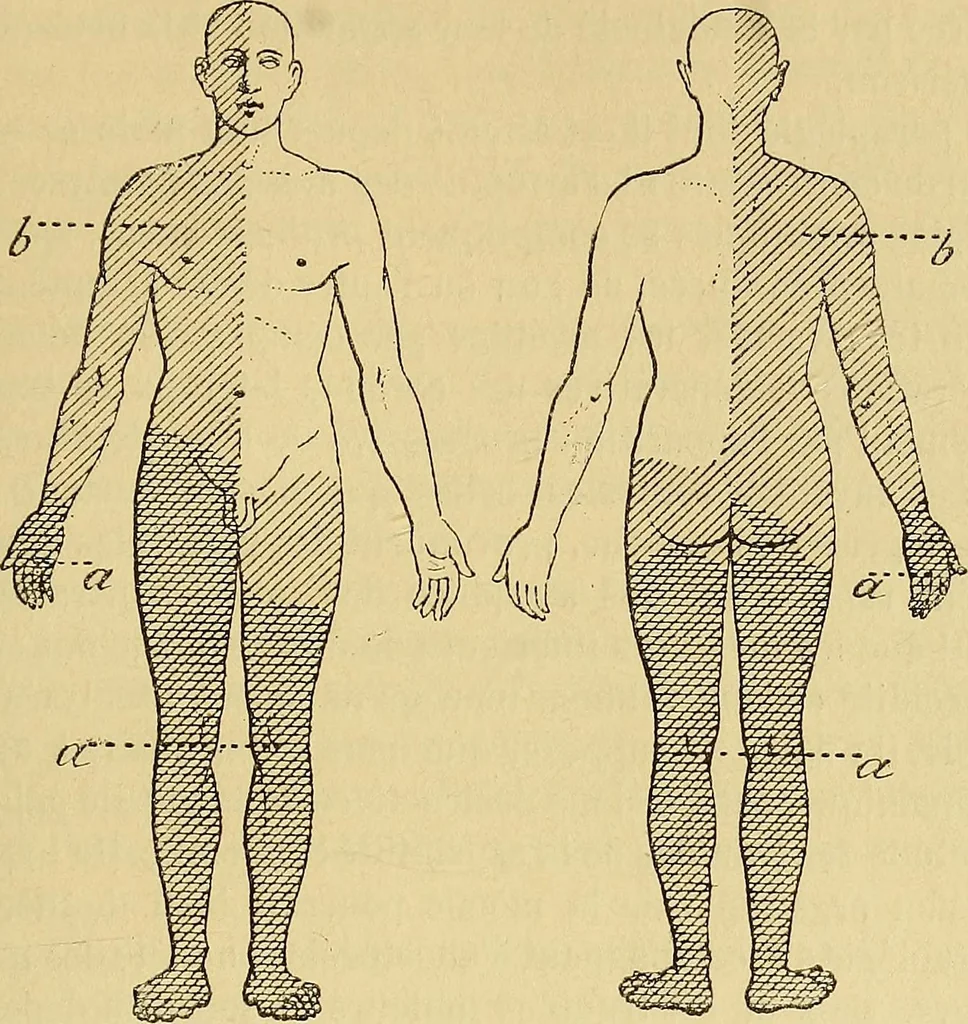 An illustration from Leçons cliniques sur l'hystérie et l'hypnotisme : faites à l'Hôpital Saint-André de Bordeaux, 1891, leaf 472