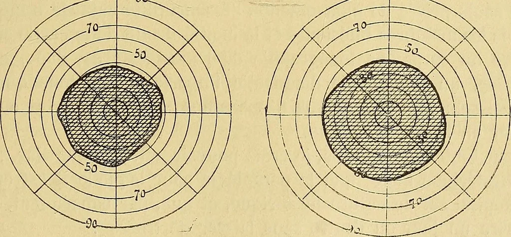 An illustration from Leçons cliniques sur l'hystérie et l'hypnotisme : faites à l'Hôpital Saint-André de Bordeaux, 1891, leaf 472