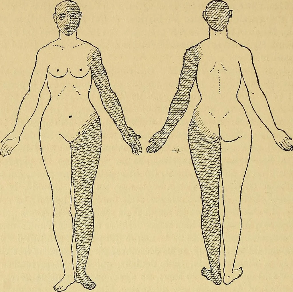 An illustration from Leçons cliniques sur l'hystérie et l'hypnotisme : faites à l'Hôpital Saint-André de Bordeaux, 1891, leaf 501