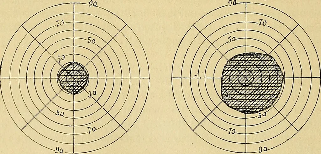 An illustration from Leçons cliniques sur l'hystérie et l'hypnotisme : faites à l'Hôpital Saint-André de Bordeaux, 1891, leaf 501