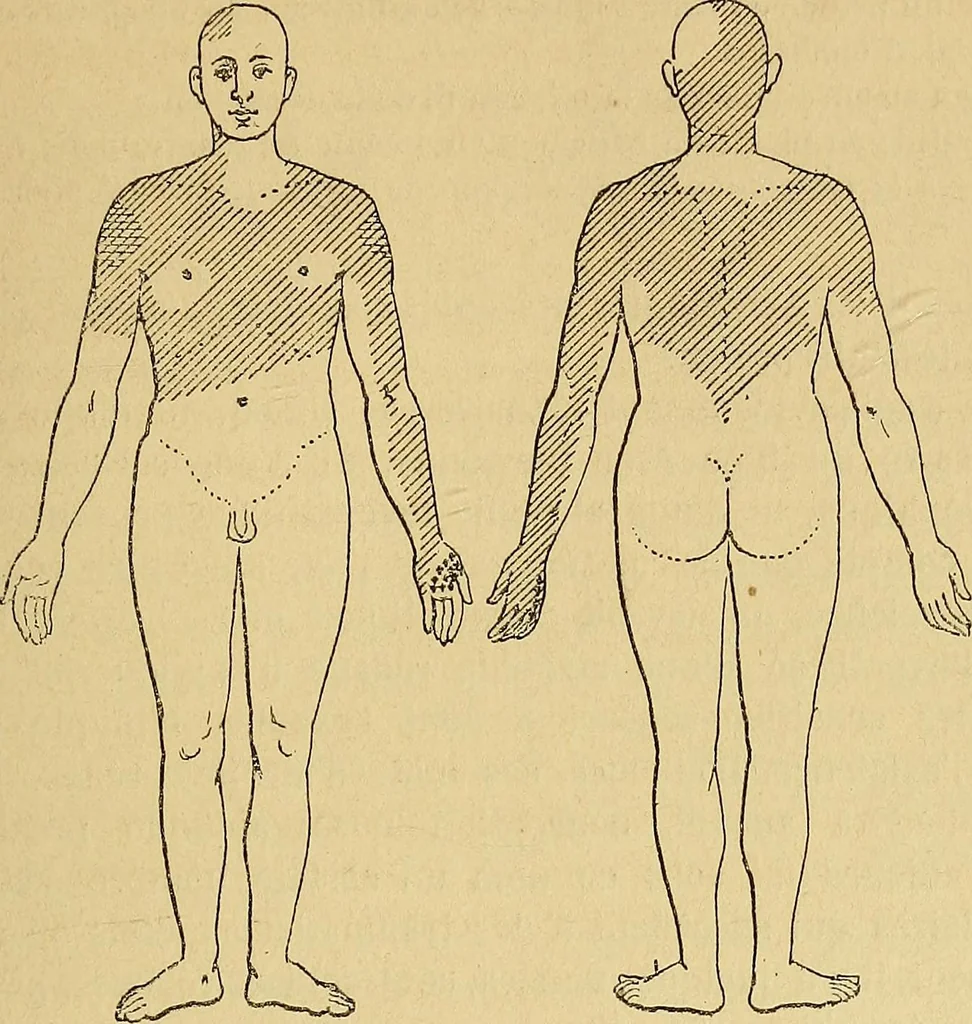 An illustration from Leçons cliniques sur l'hystérie et l'hypnotisme : faites à l'Hôpital Saint-André de Bordeaux, 1891, leaf 508