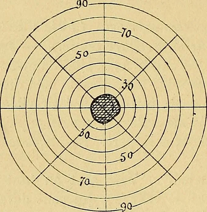 An illustration from Leçons cliniques sur l'hystérie et l'hypnotisme : faites à l'Hôpital Saint-André de Bordeaux, 1891, leaf 513