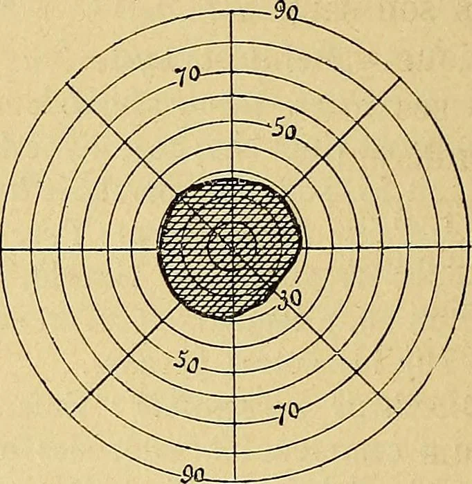 An illustration from Leçons cliniques sur l'hystérie et l'hypnotisme : faites à l'Hôpital Saint-André de Bordeaux, 1891, leaf 513