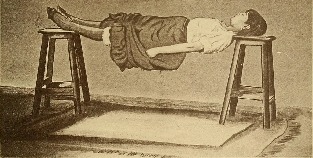 An illustration from Leçons cliniques sur l'hystérie et l'hypnotisme : faites à l'Hôpital Saint-André de Bordeaux, 1891, leaf 518