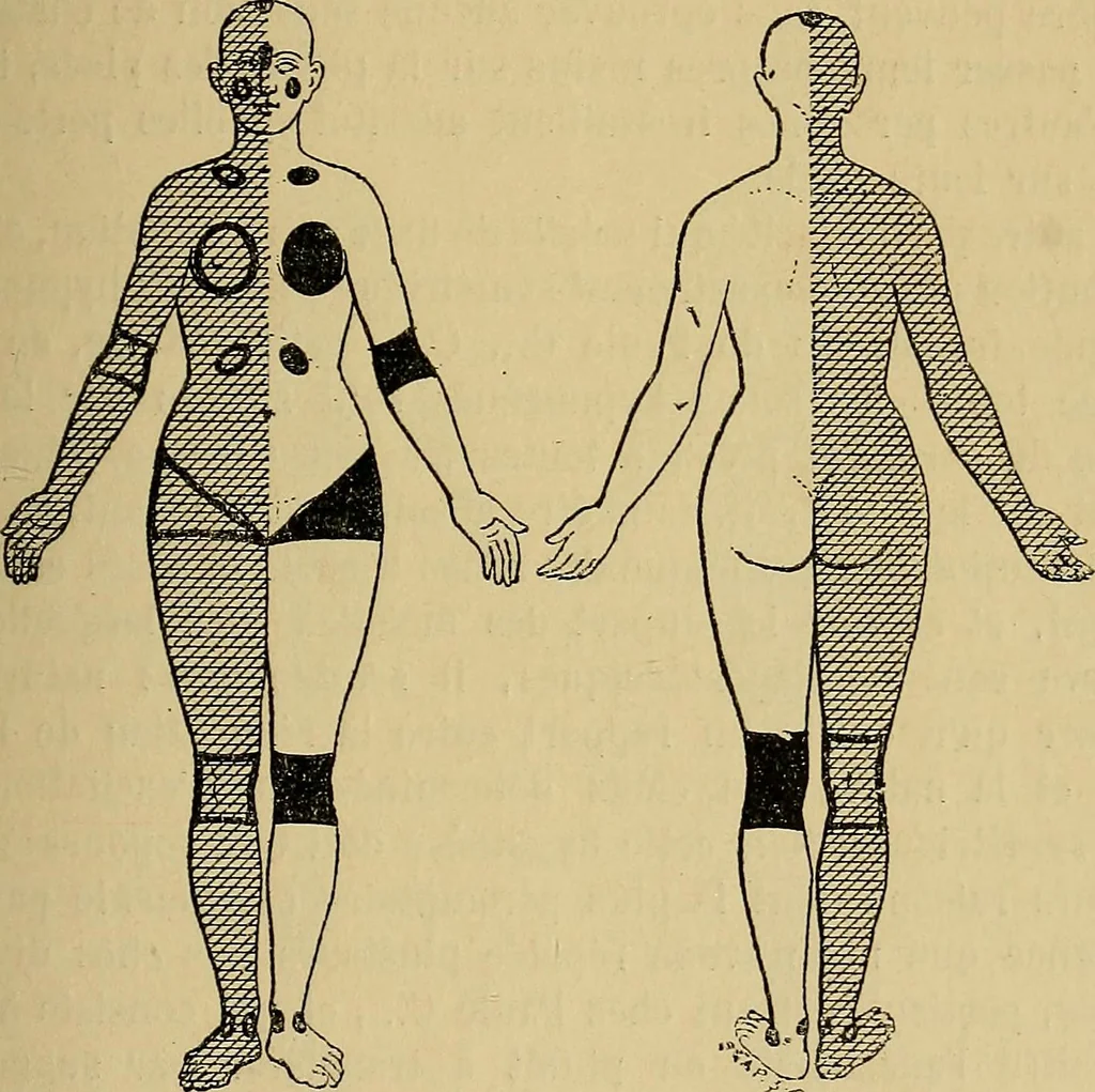 An illustration from Leçons cliniques sur l'hystérie et l'hypnotisme : faites à l'Hôpital Saint-André de Bordeaux, 1891, leaf 116