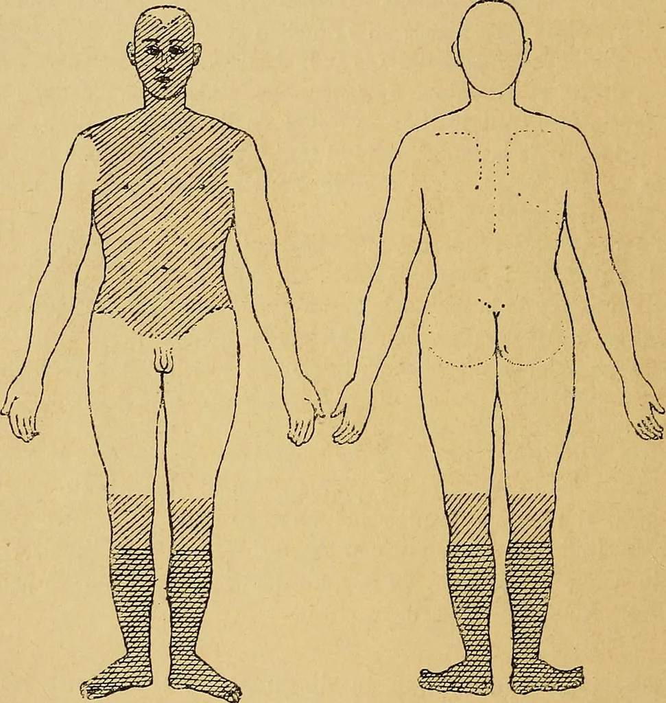 An illustration from Leçons cliniques sur l'hystérie et l'hypnotisme : faites à l'Hôpital Saint-André de Bordeaux, 1891, leaf 17