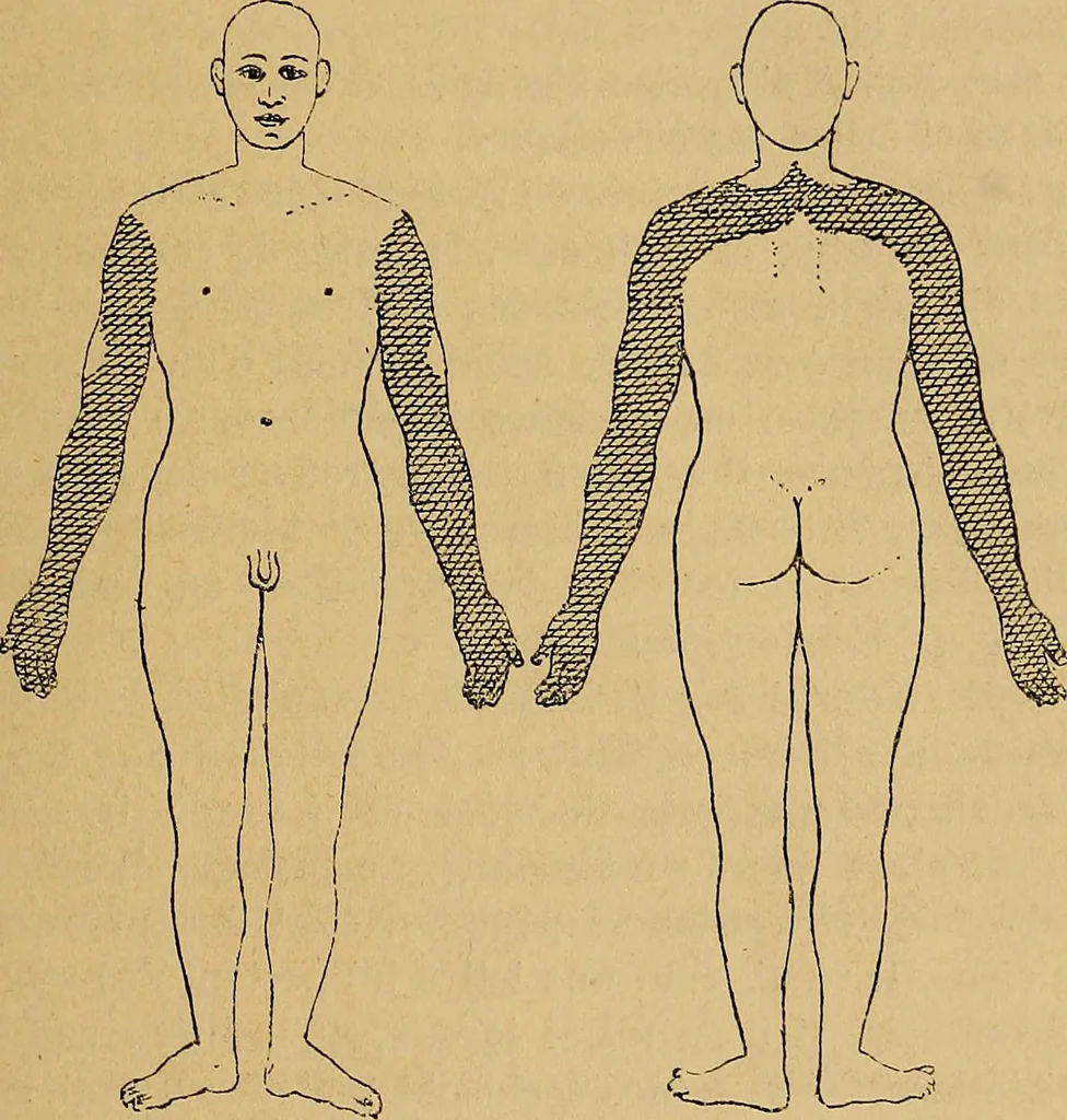 An illustration from Leçons cliniques sur l'hystérie et l'hypnotisme : faites à l'Hôpital Saint-André de Bordeaux, 1891, leaf 18