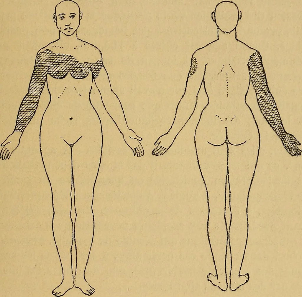 An illustration from Leçons cliniques sur l'hystérie et l'hypnotisme : faites à l'Hôpital Saint-André de Bordeaux, 1891, leaf 24