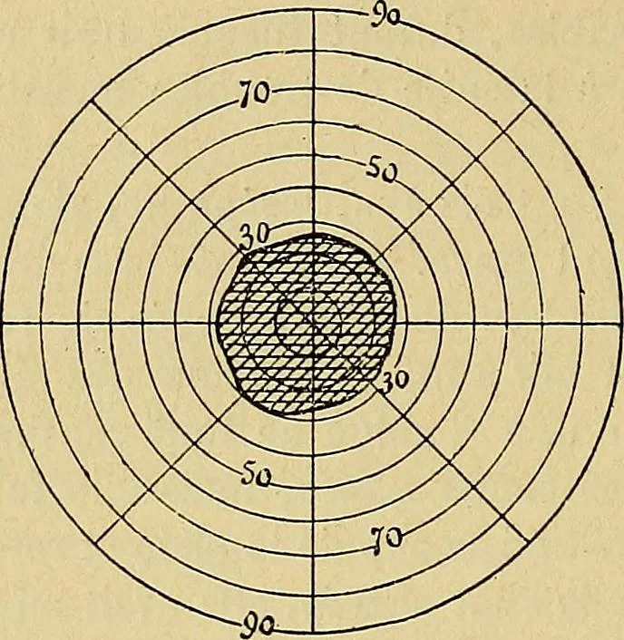An illustration from Leçons cliniques sur l'hystérie et l'hypnotisme : faites à l'Hôpital Saint-André de Bordeaux, 1891, leaf 255