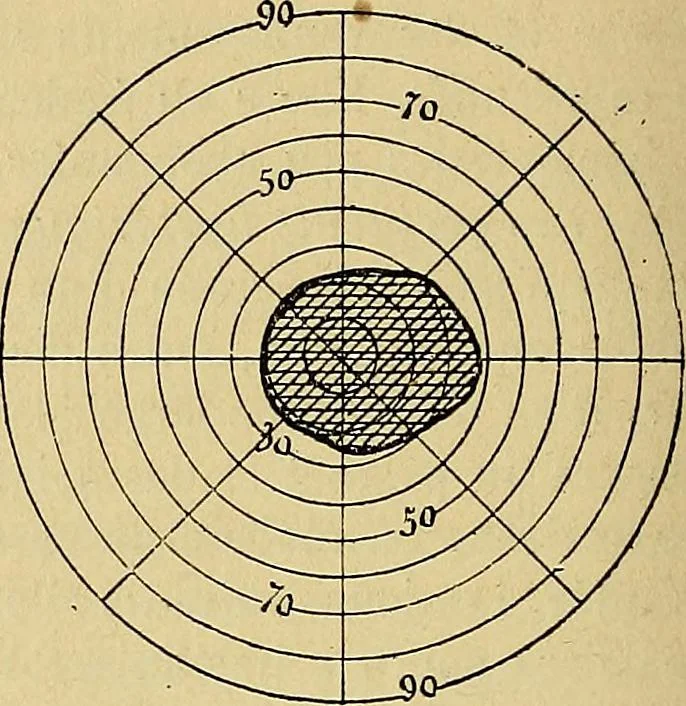 An illustration from Leçons cliniques sur l'hystérie et l'hypnotisme : faites à l'Hôpital Saint-André de Bordeaux, 1891, leaf 255