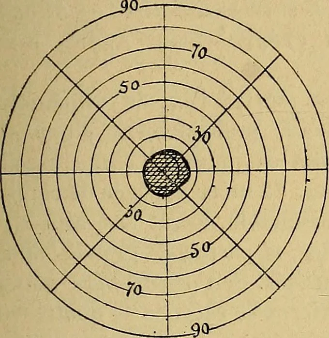 An illustration from Leçons cliniques sur l'hystérie et l'hypnotisme : faites à l'Hôpital Saint-André de Bordeaux, 1891, leaf 262